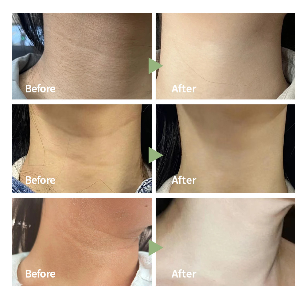 lakerain Neck Cream details Picture