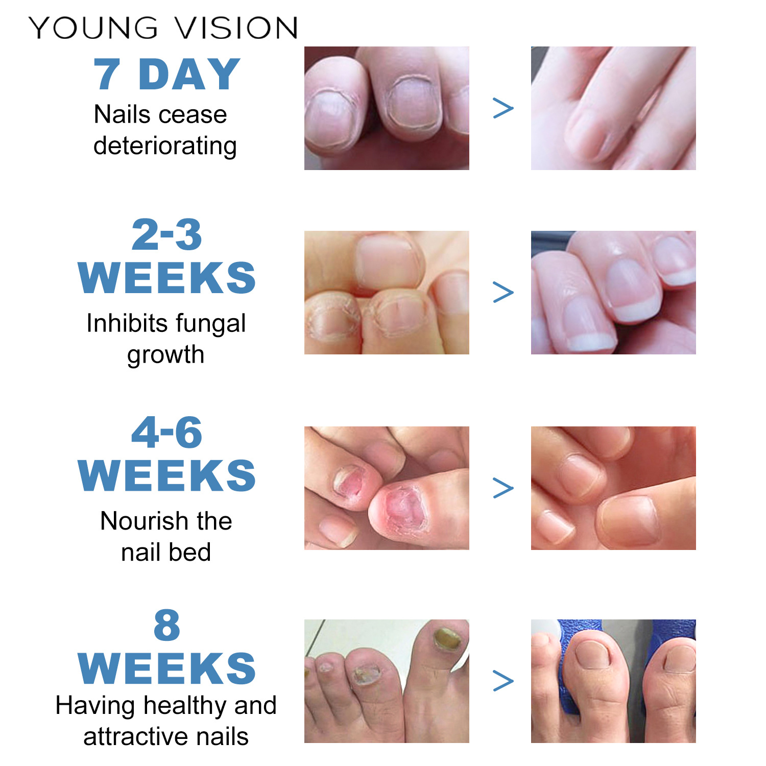 YOUNG VISION Toenail patch Specification drawing