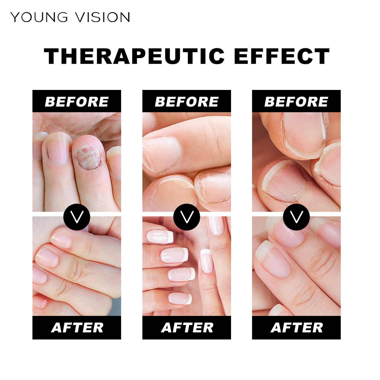 YOUNG VISION Nail Essence Beauty Nail Liquid Application Scenario