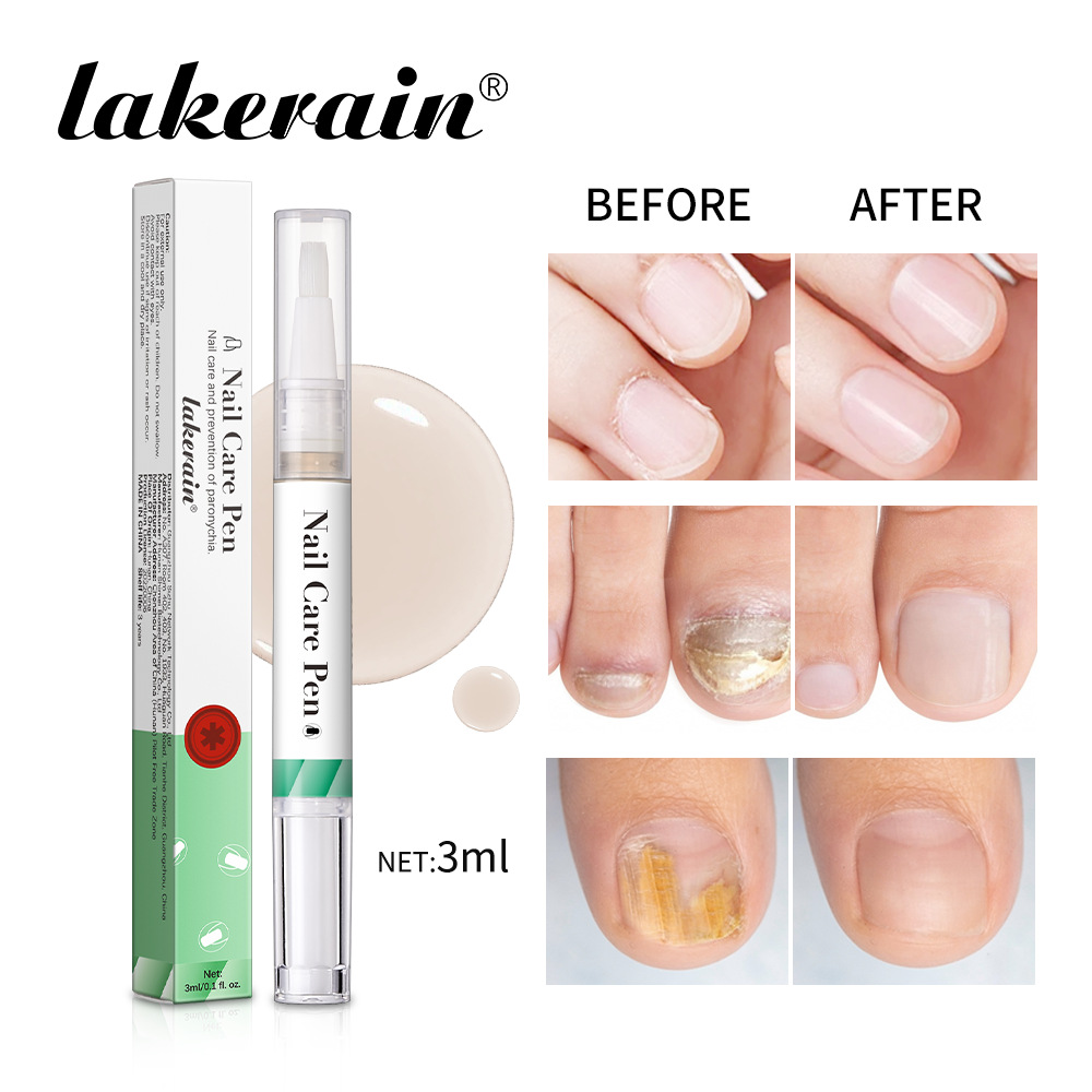 Lakerain Nail Pen Nail Oil Nail Growth Oil full figure