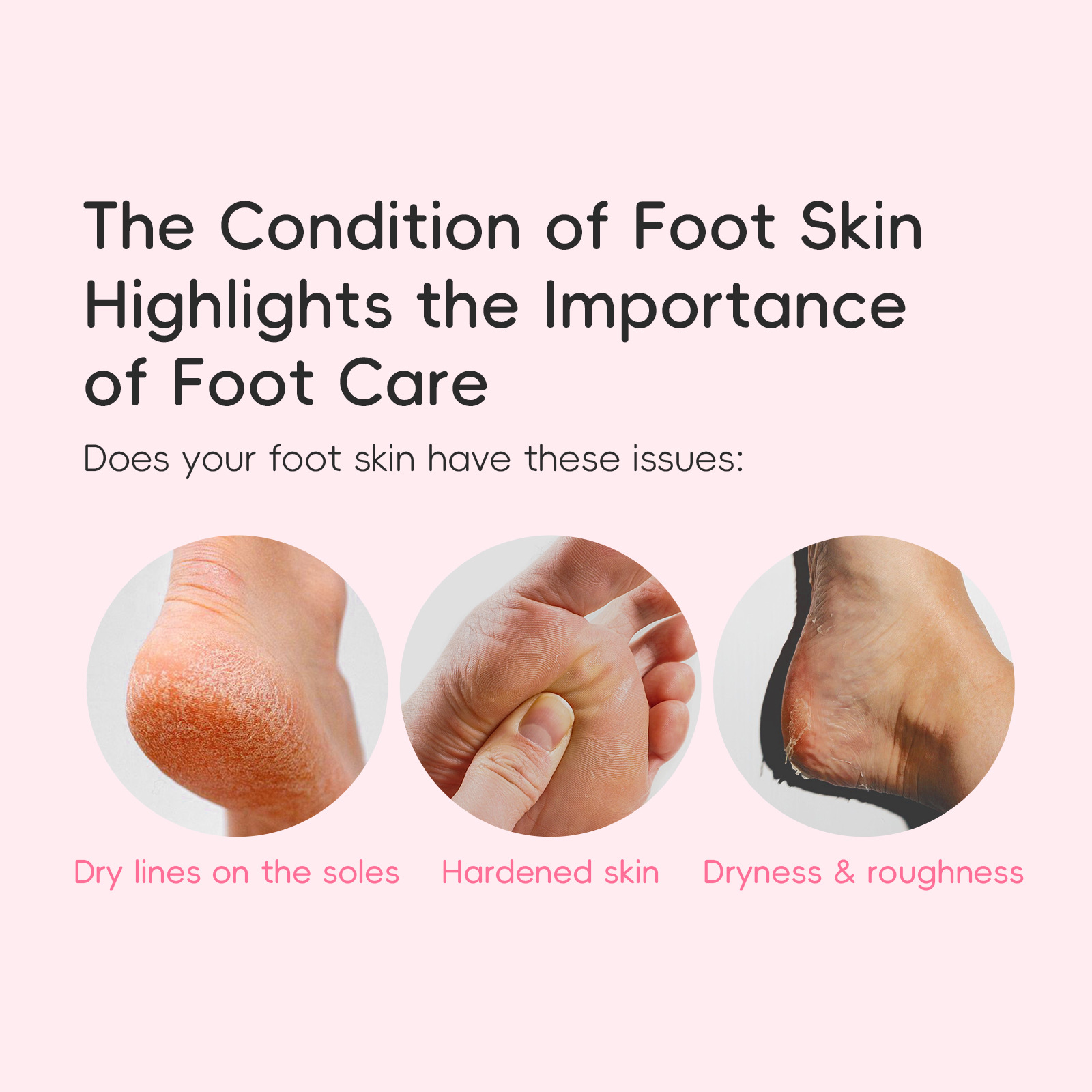 Laikou Cherry Blossom Foot Cream 30g, foot care, hydrating, Moisturizing and nourishing, factory in stock, one-piece consignment, in stock details Picture