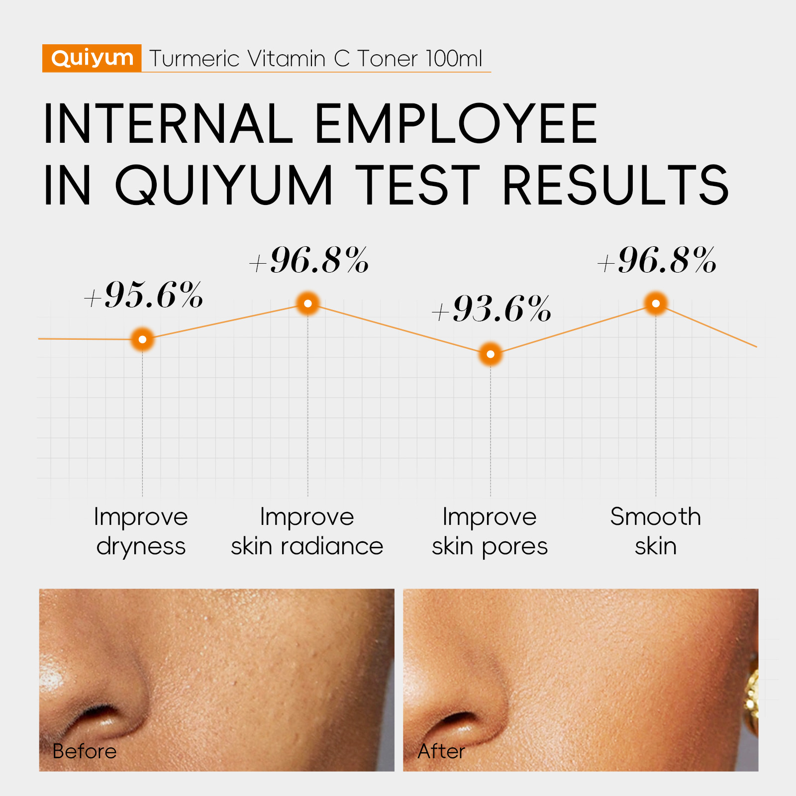 Cross-border new product QUIYUM Turmeric Vitamin c Toner 100ml for hydrating and moisturizing the face is available for wholesale from the manufacturer Specification drawing