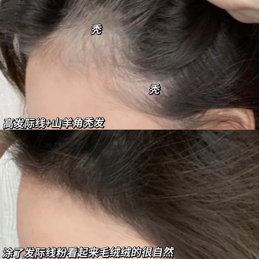 Gege bear Goge Little Bear Hairline Powder is waterproof, sweat-proof, and can modify and fill the forehead and temples. It is also a powder for shaping eyebrows Application Scenario