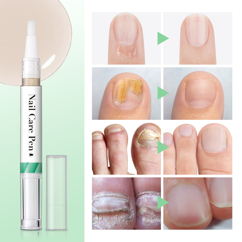 Lakerain Nail Pen Nail Oil Nail Growth Oil details Picture