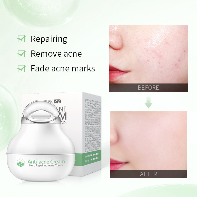 Cross-border Fenyi pro Herbal Cream 8g Hydrates, moisturizes and soothes the skin. Factory wholesale in stock, FDA cosmetics Specification drawing