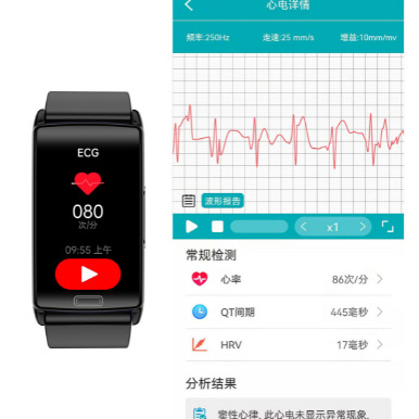 New cross-border smart bracelet watch, non-invasive blood sugar, blood pressure, blood oxygen, body temperature monitoring, sports waterproof electronic product Specification drawing