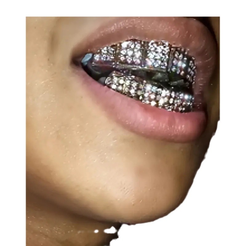 Hot-selling HIPHOP gold braces, Hiphop full diamond gold teeth, upper teeth, eight-tooth diamond braces, factory direct sales Item Picture