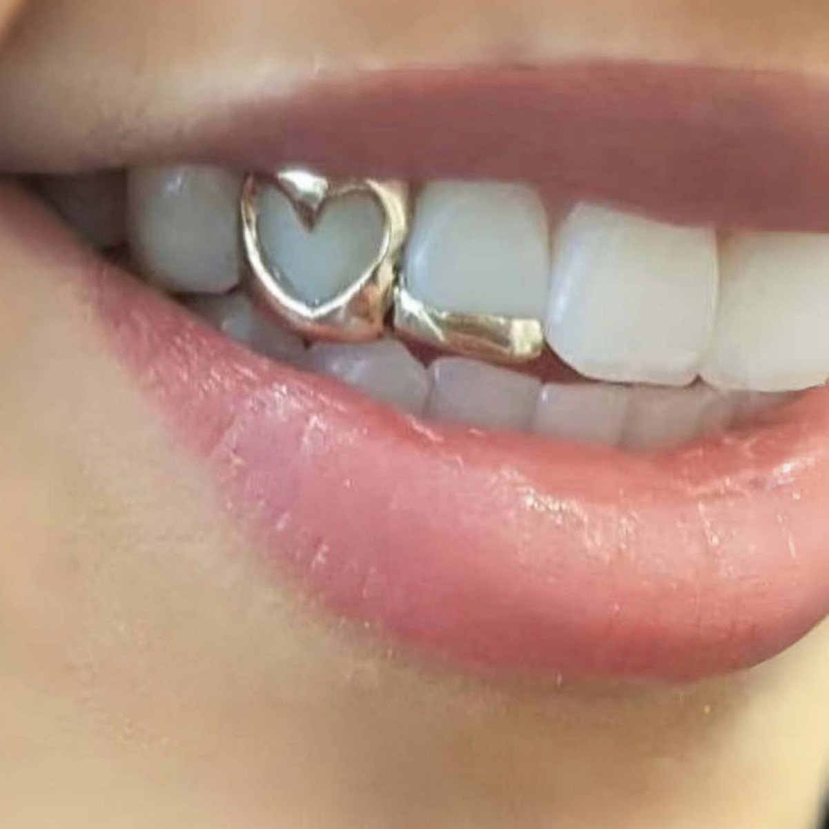 Cross-border hip-hop hollowed-out heart-shaped horizontal line double-set braces, cool and shiny gold teeth for daily outings, wholesale of matching accessories full figure