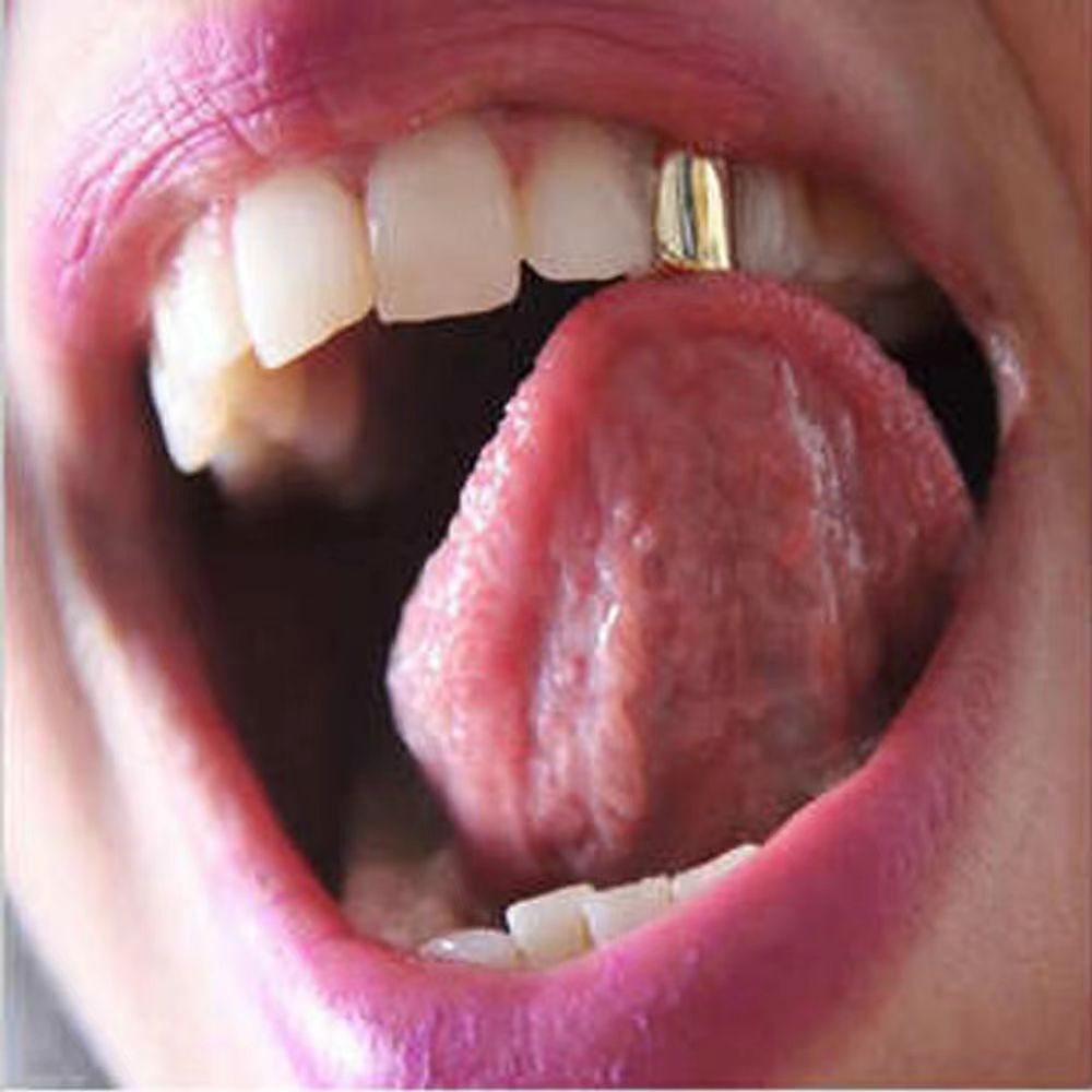 European and American cross-border HIPHOP gold braces, hip-hop single teeth, real gold electroplated hip-hop accessory braces grillz details Picture