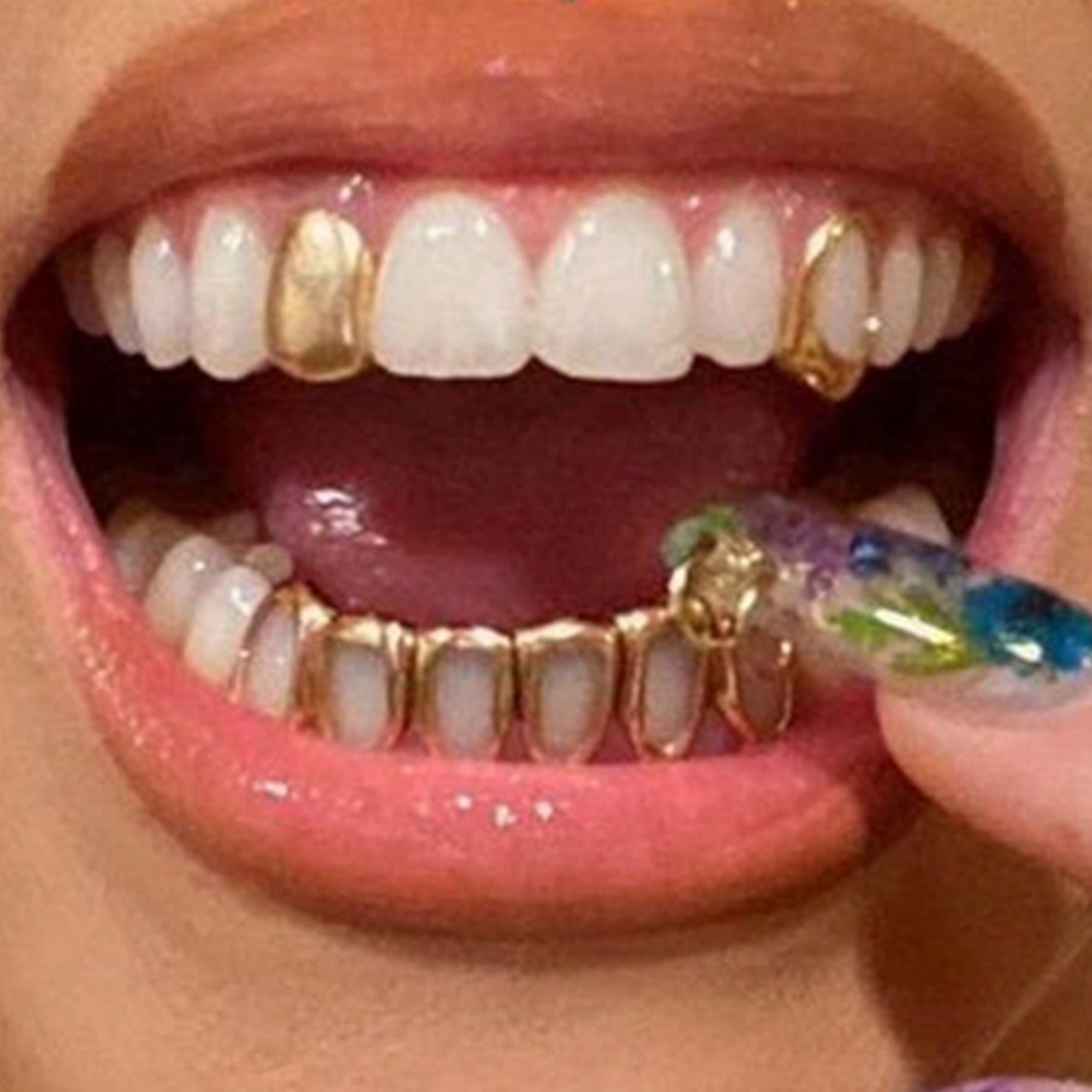 Cross-border best-selling six-hollowed-out flat teeth hip-hop braces, hip-hop teeth three-piece set, stage prop braces details Picture