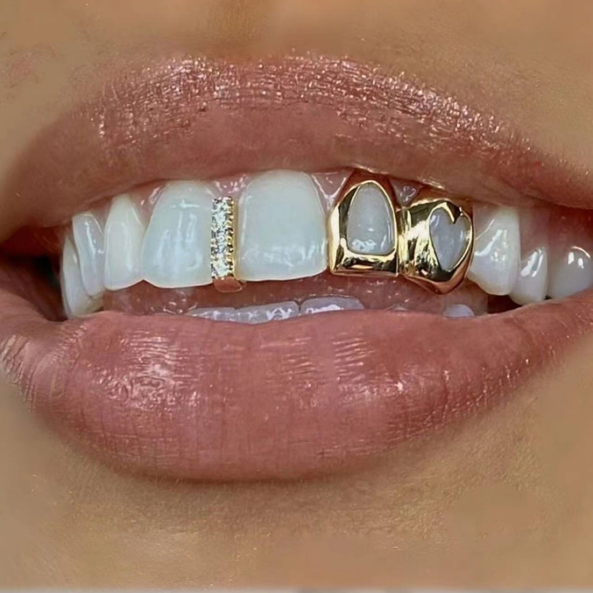 Jinwu Hollowed-out heart-shaped double-set braces, cool and stylish for daily outings, smooth gold teeth, hip-hop, versatile cross-border accessories wholesale full figure