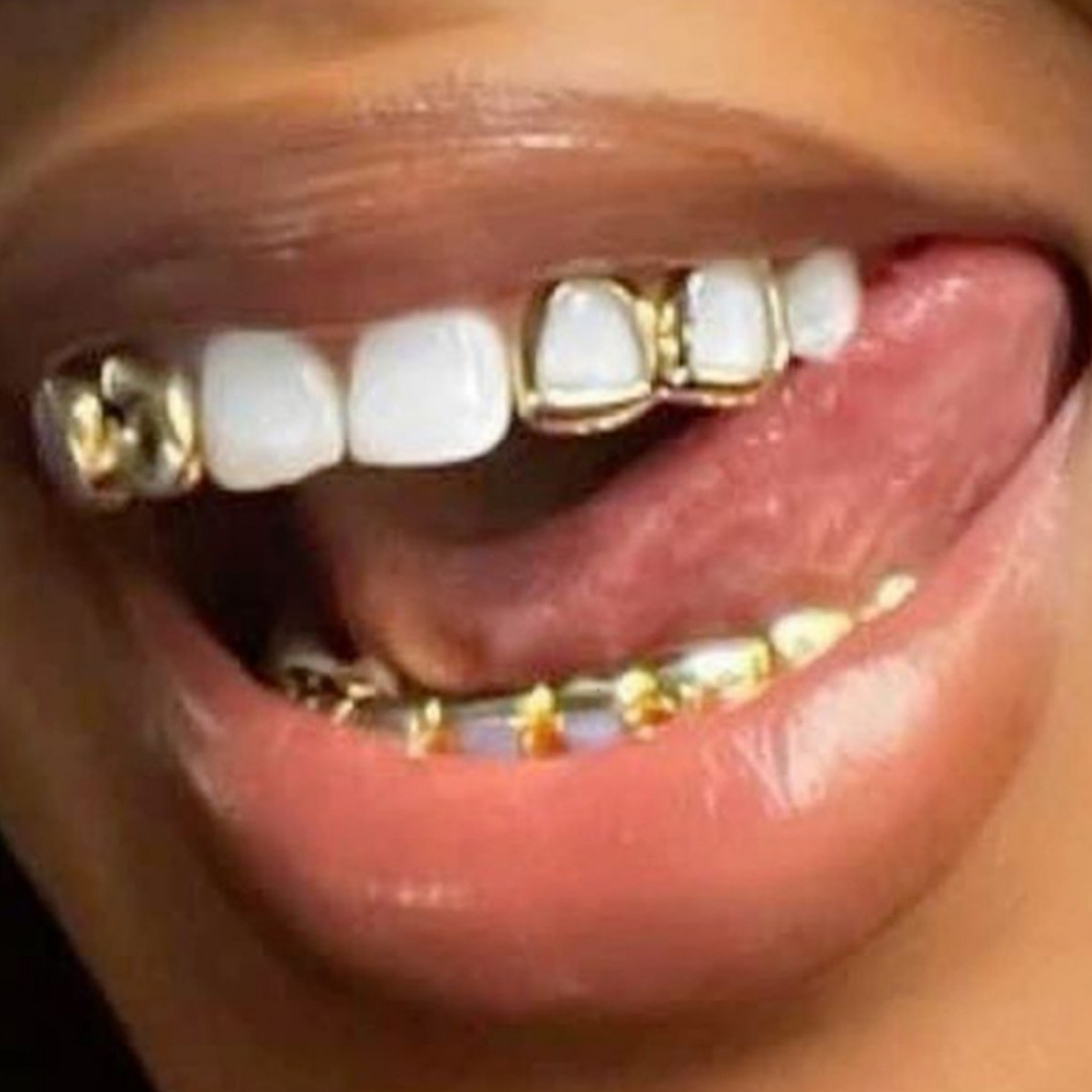 Cross-border best-selling hip-hop braces, HIPHOP double-engraved side teeth three-piece set, stage prop braces combination details Picture