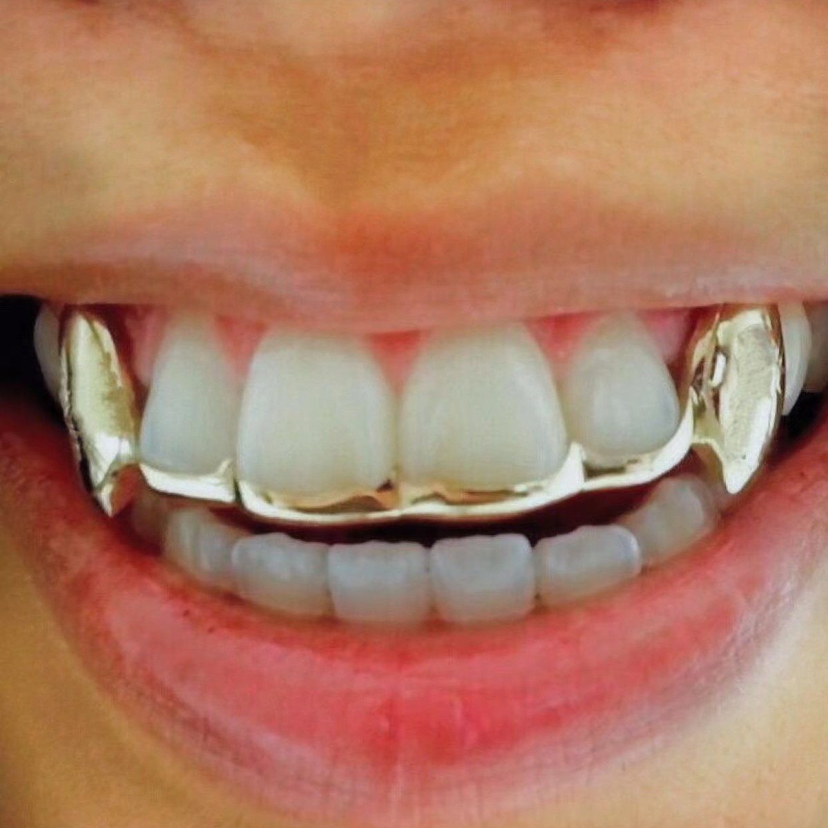 Cross-border bestseller hip-hop braces, punk Halloween vampire teeth, little tiger teeth, metal braces teeth grillz details Picture