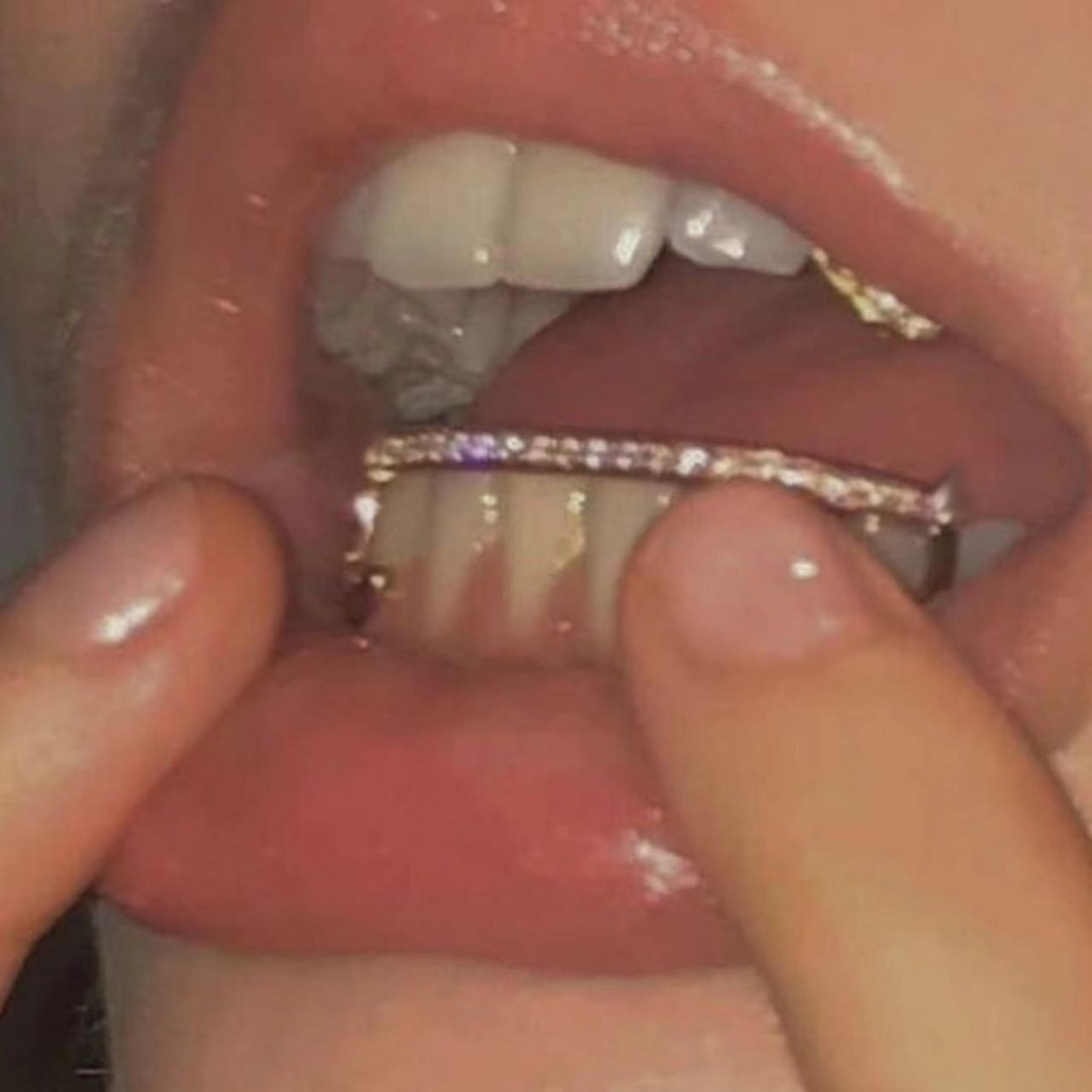 TeethGrillz, a direct-sale hip-hop zirconium-inlaid decorative braces in Europe and America, is a direct-sale product from the manufacturer with genuine gold electroplated braces full figure