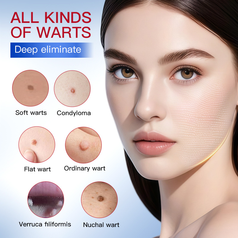 All-english SADOER anti-wart Liquid, mole removal pen, smooth and flawless skin absorption essence pen, cross-border export wholesale Application Scenario