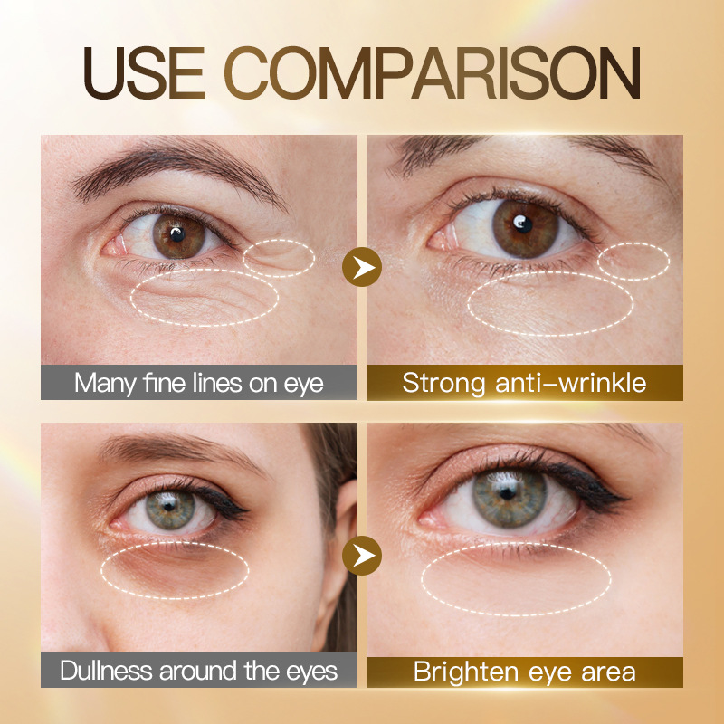 Cross-border export wholesale of SADOER bone collagen hyaluronic Acid Firming freeze-dried eye Mask and Moisturizing Eye Area Eye Mask Application Scenario