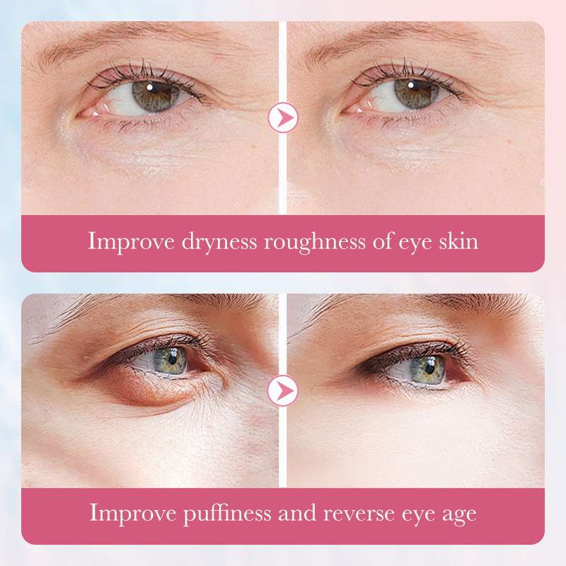 SADOER Sakura Collagen Multi-Effect Nourishing Eye Cream and Moisturizing Eye Cream Cross-border export wholesale Application Scenario