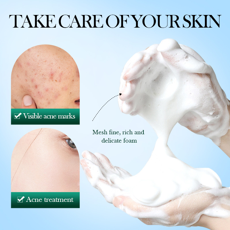 SADOER Tea Tree Acne and Oil Control Bubble Facial Cleanser, Gentle cleansing, student Facial Cleanser, cross-border wholesale Specification drawing