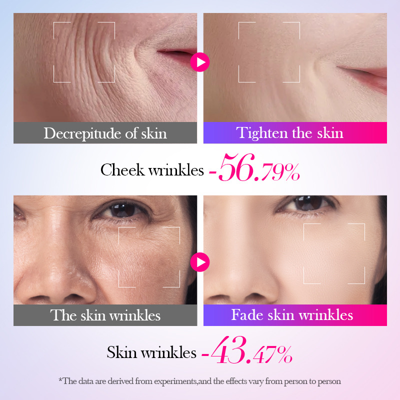 SADOER Snail Recombinant Collagen Cream Moisturizing and Hydrating Cream Cross-border export wholesale Application Scenario