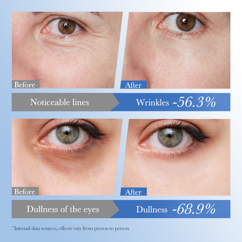 Cross-border export wholesale of SADOER caviar hyaluronic acid Anti-wrinkle Repair Moisturizing Eye Cream and hydrating Eye cream Application Scenario