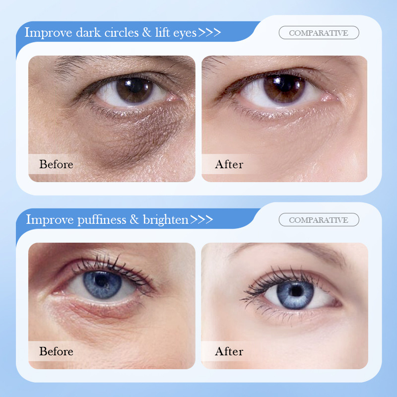 Full English SADOER8D Hyaluronic Acid Anti-wrinkle and Firming skin care product set, facial cleanser and eye cream cross-border export wholesale Application Scenario