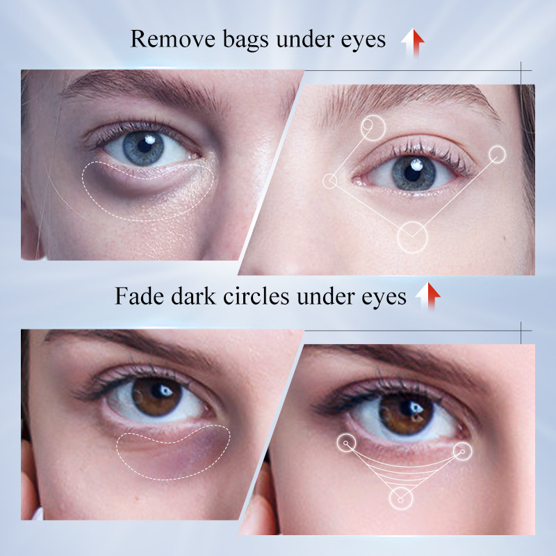 SADOER Kojic acid Whitening and spot-removing Eye Cream, Eye Moisturizing and brightening Eye cream, cross-border export wholesale Item Picture