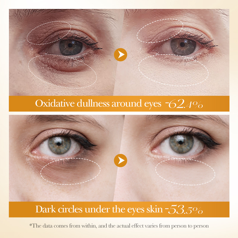 BIOAOUA Turmeric Antioxidant Soothing Eye Cream, Brightening, Moisturizing and Hydrating Eye Cream Cross-border export wholesale Application Scenario