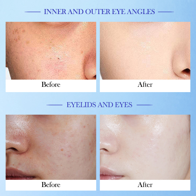 Cross-border export wholesale of SADOER high Moisturizing Vitamin E Cream for hydrating, moisturizing, rejuvenating and nourishing face cream Item Picture