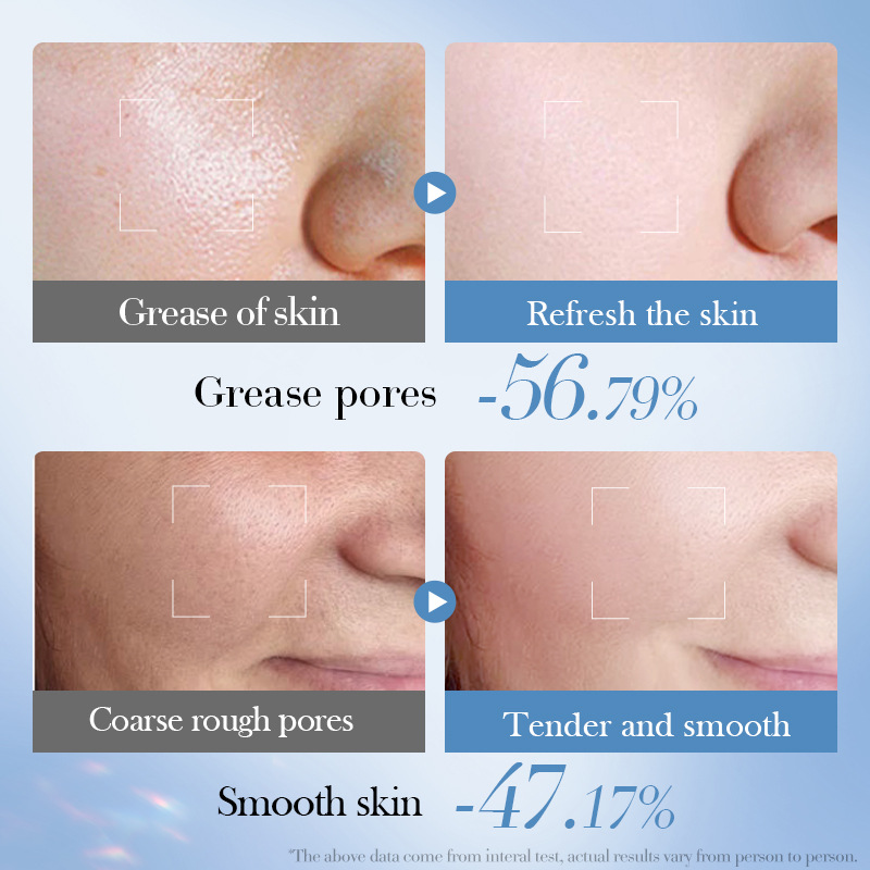 SADOER Salicylic acid Oil Control and Repair Cream, Moisturizing and Hydrating Cream, cross-border export wholesale Item Picture