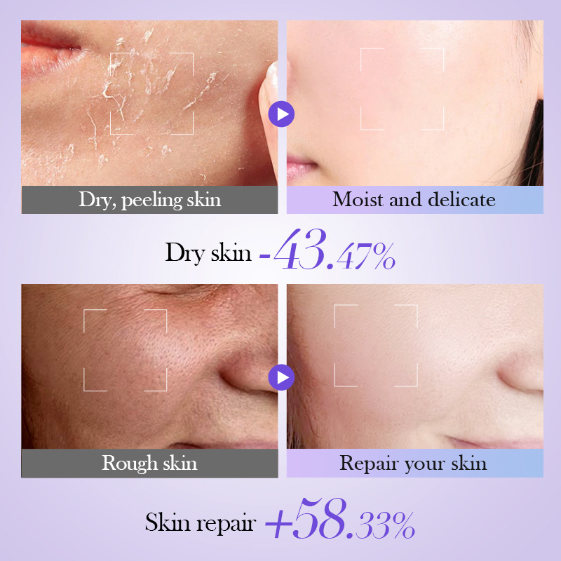 All-english BIOAOUA Retinol Anti-Wrinkle Firming Toner Moisturizing Water Cross-border export wholesale Application Scenario
