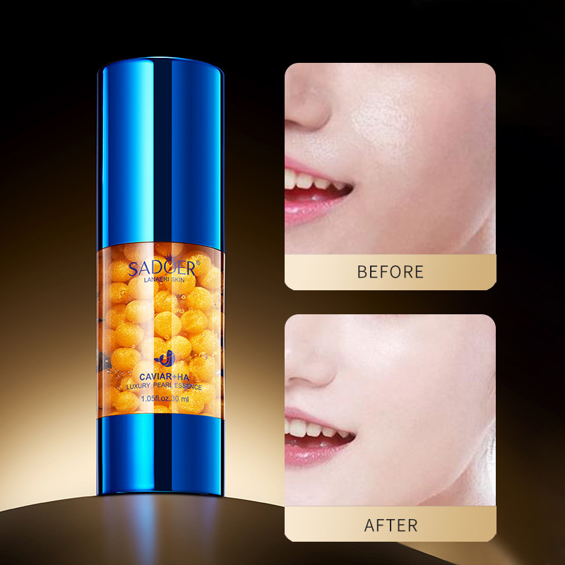 Cross-border export wholesale of SADOER caviar hyaluronic Acid Luxury Moisturizing Pearl Essence Moisturizing and Nourishing Water Cream Application Scenario