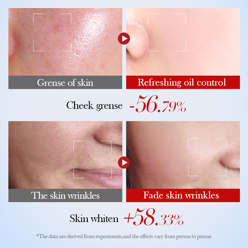 SADOER Snail Collagen Gentle Facial Cleanser, non-irritating facial cleanser, cross-border export wholesale Application Scenario