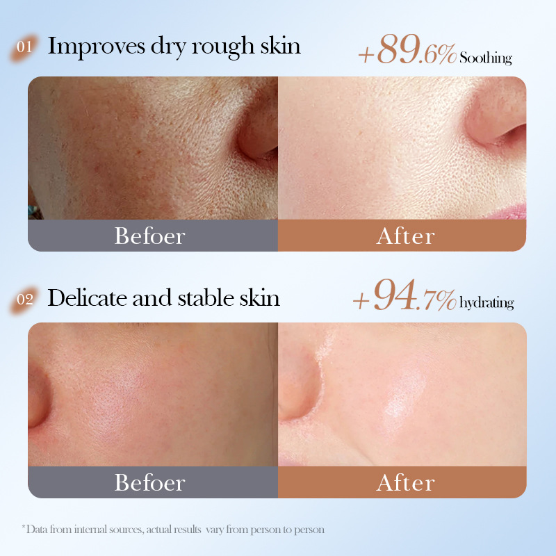 Cross-border export wholesale of SADOER coconut oil Nourishing and Moisturizing Facial mask Application Scenario