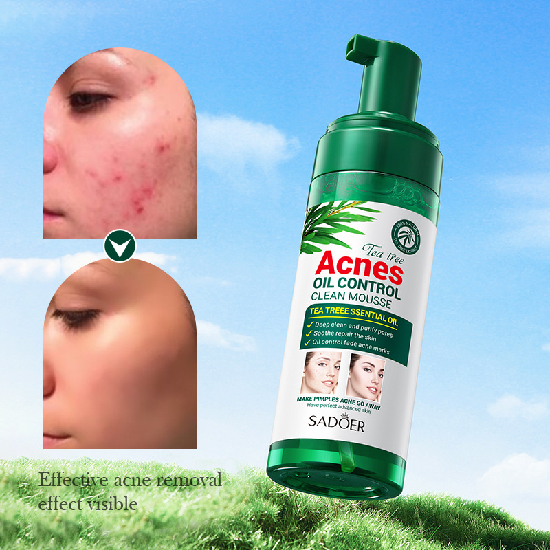 SADOER Tea Tree Acne and Oil Control Bubble Facial Cleanser, Gentle cleansing, student Facial Cleanser, cross-border wholesale Item Picture