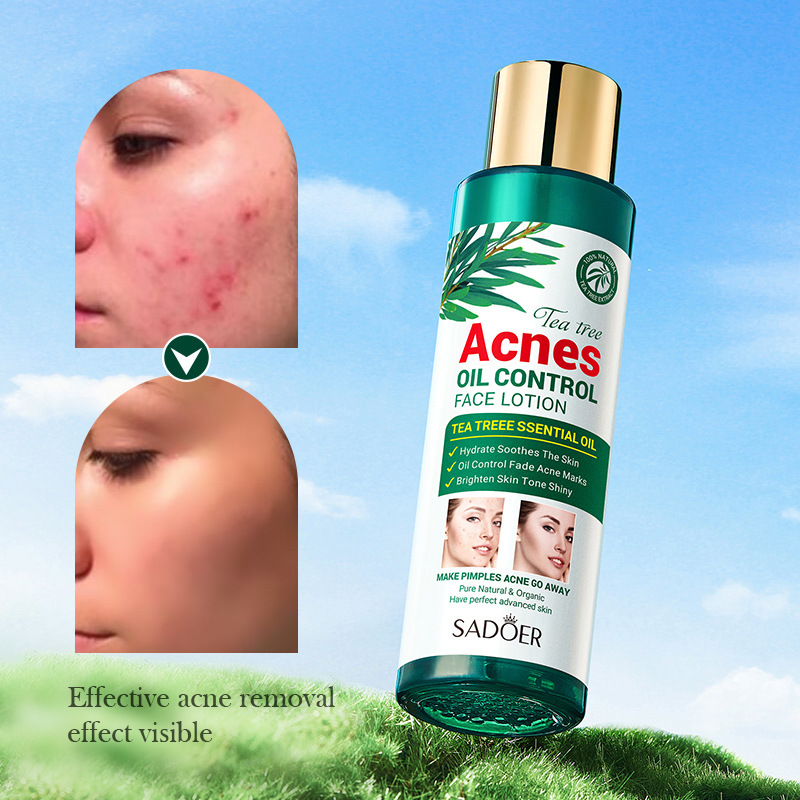 Full English SADOER Tea Tree Acne and Oil Control Lotion, Acne Mark Removal, Anti-acne and Moisturizing Water and Lotion Cross-border export wholesale Item Picture