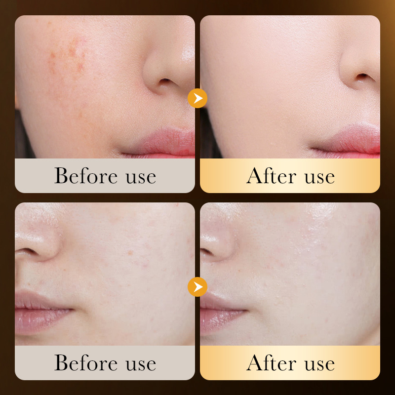 All-english ZOZU24K Gold Hyaluronic Acid Moisturizing and Repairing Essence Moisturizing Serum Cross-border export Wholesale Item Picture