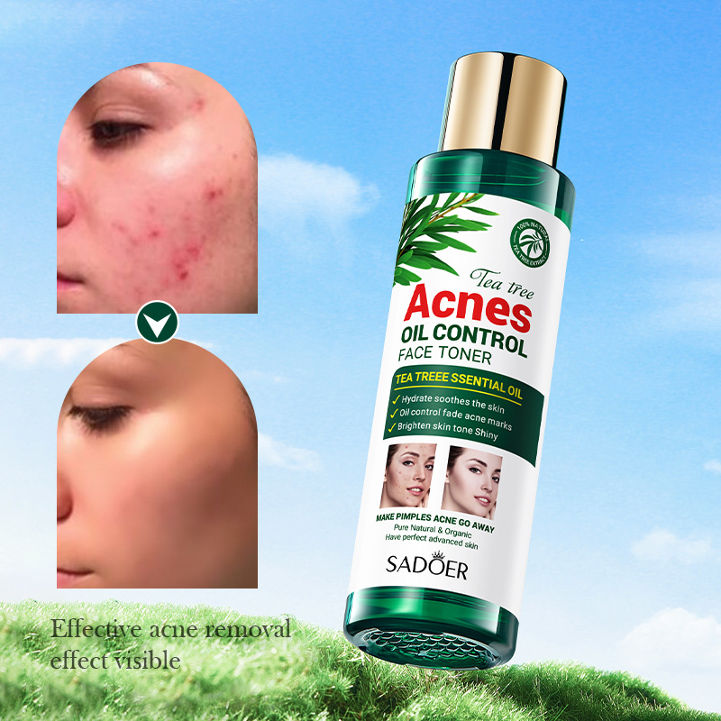 Cross-border wholesale of SADOER tea tree Acne and Oil Control Toner and Student Moisturizing and rejuvenating Water Item Picture