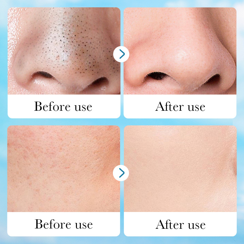 Cross-border wholesale of SADOER aloe Vera pore-Cleansing Solid Mask for cleansing facial mud Application Scenario