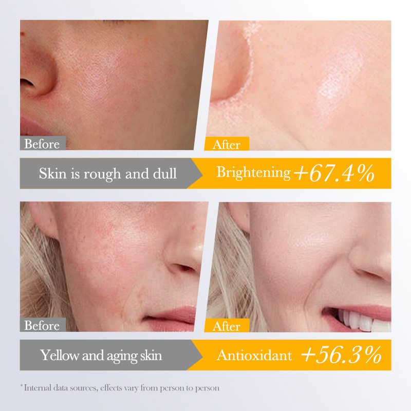 Cross-border wholesale of BIOAOUA Hyaluronic Acid and Vitamin C Whitening Facial mask in English Application Scenario