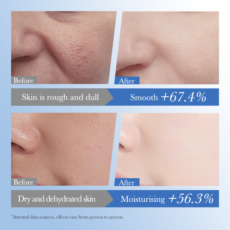 Cross-border wholesale of SADOER Vitamin B5 Moisturizing and Repairing Facial mask and hydrating facial Mask in English Application Scenario