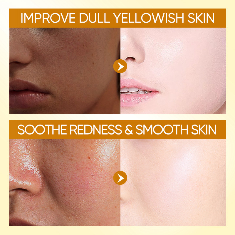 All-english BIOAOUA Turmeric Antioxidant Soothing Lotion Moisturizing and Hydrating Lotion Cross-border export wholesale Application Scenario