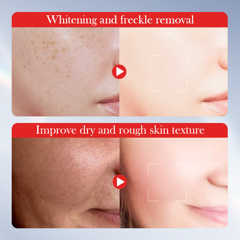 SADOER Kojic Acid Whitening and Spot-Removing Cream 50g, Moisturizing and brightening Skin cream, cross-border export wholesale Application Scenario