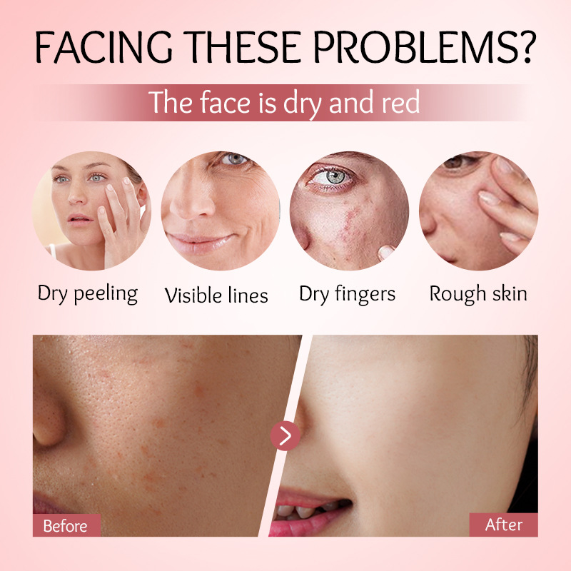 Cross-border export wholesale of SADOER Milk Peach Moisturizing Nourishing Essence and Hydrating Essence in full English Application Scenario
