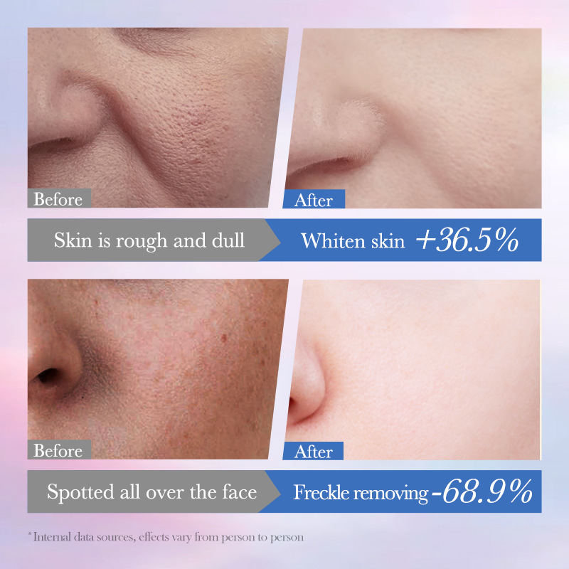 Cross-border wholesale of SADOER Niacinamide Whitening, Freckle-removing and Repairing Essence and Moisturizing and Brightening Essence in full English Application Scenario