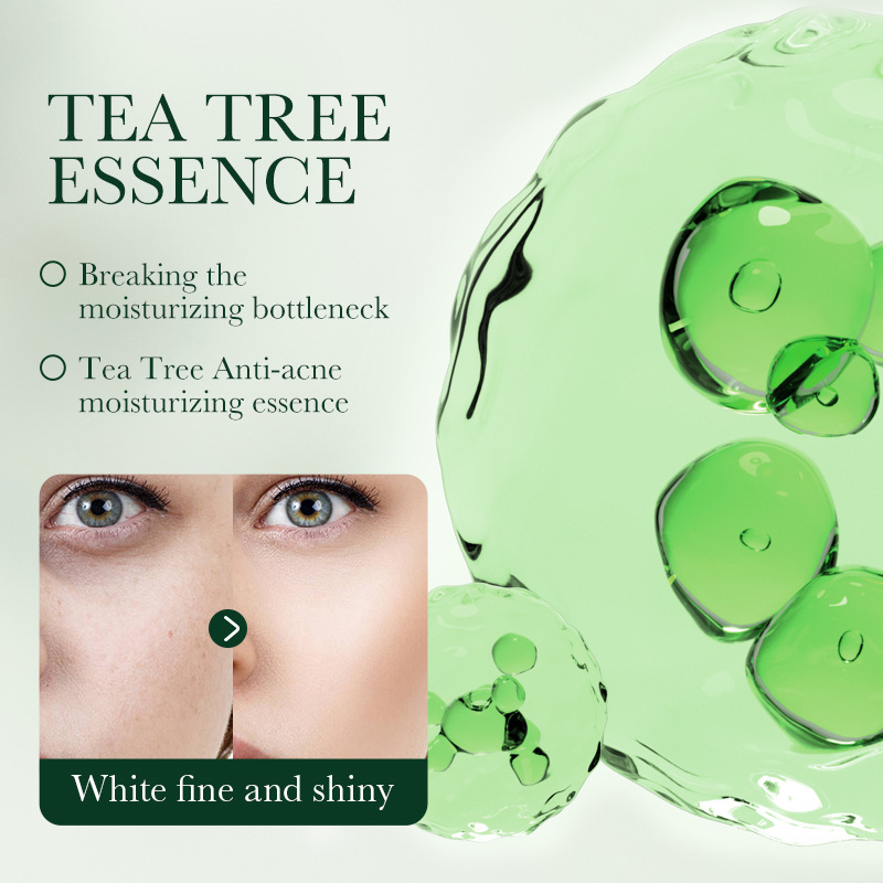SADOER tea Tree Acne and Oil Control Cream, student face anti-acne Cream, cross-border export wholesale Application Scenario