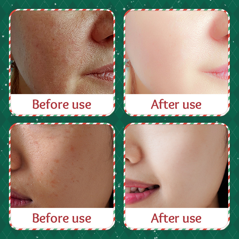Cross-border wholesale of SADOER Christmas Avocado Moisturizing Facial mask and hydrating facial Mask in English Application Scenario