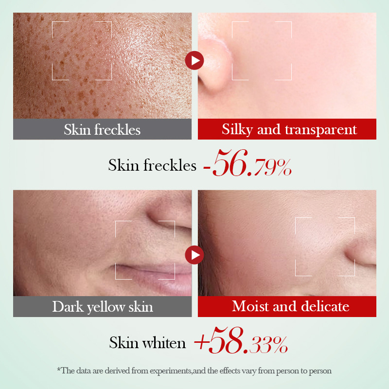 SADOER Niacinamide Whitening and Brightening Lotion Moisturizing and hydrating Skin cross-border export wholesale Application Scenario