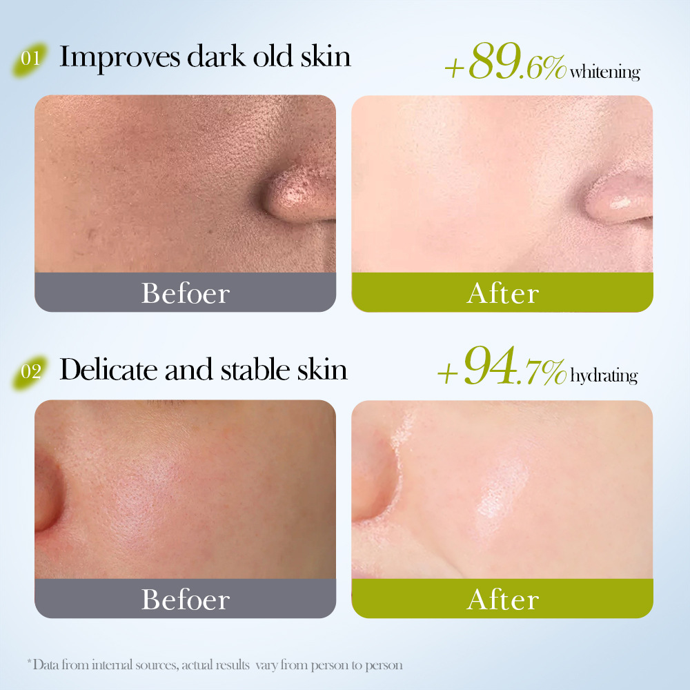 Cross-border export wholesale of SADOER kiwi Fruit Whitening, Antioxidant, Anti-wrinkle, Hydrating and Moisturizing Mask in full English Application Scenario