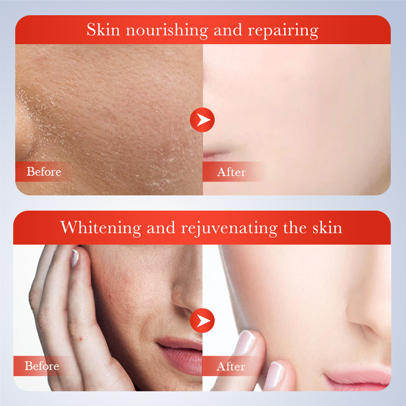 Cross-border wholesale of SADOER Kojic Acid Whitening and Spot-Removing Essence, Hydrating, rejuvenating and brightening Essence in English Item Picture