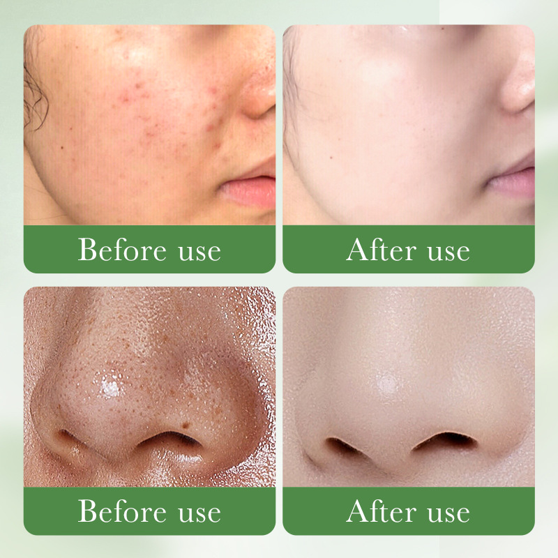 Cross-border wholesale of SADOER salicylic acid acne-fighting amino acid skin care products and facial cleansers in full English Item Picture
